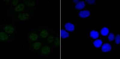Immunocytochemistry/Immunofluorescence: SIN3A Antibody (JA94-31) [NBP2-67146] - Staining mSin3A in Hela cells (green). The nuclear counter stain is DAPI (blue). Cells were fixed in paraformaldehyde, permeabilised with 0.25% Triton X100/PBS.