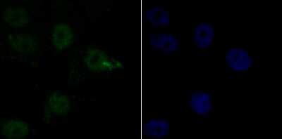 Immunocytochemistry/Immunofluorescence: SIN3A Antibody (JA94-31) [NBP2-67146] - Staining mSin3A in MCF-7 cells (green). The nuclear counter stain is DAPI (blue). Cells were fixed in paraformaldehyde, permeabilised with 0.25% Triton X100/PBS.