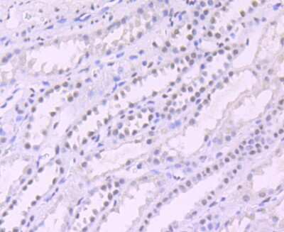 Immunohistochemistry-Paraffin: SIN3A Antibody (JA94-31) [NBP2-67146] - Analysis of paraffin-embedded human kidney tissue using anti-mSin3A antibody. Counter stained with hematoxylin.