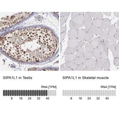 Immunohistochemistry-Paraffin SIPA1L1 Antibody - BSA Free