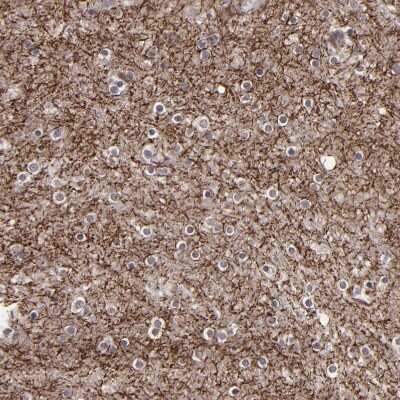 Immunohistochemistry-Paraffin SIPA1L1 Antibody - BSA Free