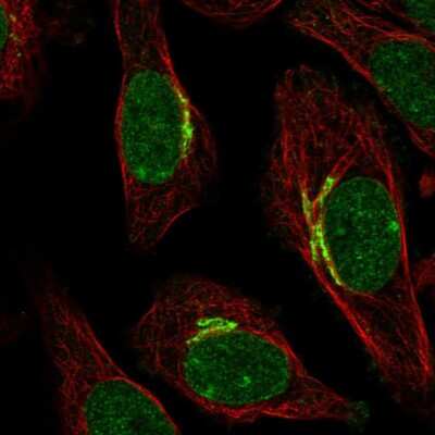 Immunocytochemistry/Immunofluorescence: SIPA1L2 Antibody [NBP2-55576] - Staining of human cell line SiHa shows localization to nuclear bodies, nuclear membrane & the Golgi apparatus.