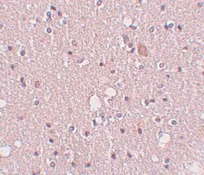Immunohistochemistry-Paraffin: SIPA1L2 Antibody [NBP1-77090] - Human brain tissue with SIPA1L2 antibody at 5 ug/ml.