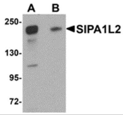 Western Blot: SIPA1L2 Antibody [NBP1-77090] - Analysis of SIPA1L2 in rat brain tissue lysate with SIPA1L2 antibody at 1 ug/ml in (A) the absence and (B) the presence of blocking peptide.