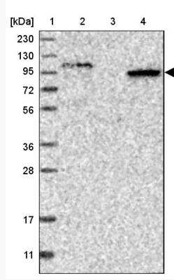 Western Blot: SIPA1L2 Antibody [NBP1-81412] - Lane 1: Marker [kDa] 230, 130, 95, 72, 56, 36, 28, 17, 11 Lane 2: Human cell line RT-4 Lane 3: Human cell line U-251MG sp Lane 4: Human plasma (IgG/HSA depleted)