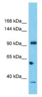 Western Blot: SIPA1L2 Antibody [NBP3-09888] - Western blot analysis of SIPA1L2 in Human 721_B Whole Cell. Antibody dilution at 1ug/ml