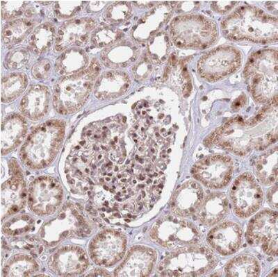 Immunohistochemistry: SIPA1L3 Antibody [NBP2-30563] - Staining of human kidney shows moderate nuclear and cytoplasmic positivity in renal tubules.