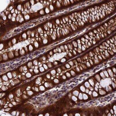 Immunohistochemistry: SIPA1L3 Antibody [NBP2-30602] - Staining of human colon shows strong cytoplasmic and membrane positivity in glandular cells.