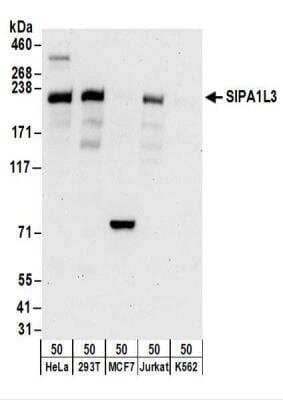 Western Blot: SIPA1L3 Antibody [NBP2-30362] - Whole cell lysate (50 ug) from HeLa, 293T, MCF7, Jurkat, and K562 cells.   Antibody was used for WB at 0.4 ug/ml.  Detection: Chemiluminescence with an exposure time of 30 seconds.