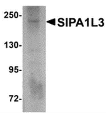 Western Blot: SIPA1L3 Antibody [NBP2-81902] - Analysis of SIPA1L3 in SK-N-SH lysate with SIPA1L3 antibody at 1 ug/ml.