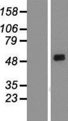 Western Blot: SIRP alpha Overexpression Lysate (Adult Normal) [NBP2-10624] Left-Empty vector transfected control cell lysate (HEK293 cell lysate); Right -Over-expression Lysate for SIRP alpha.