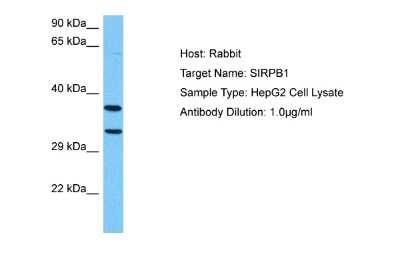 Western Blot: SIRP beta 1/CD172b Antibody [NBP2-83528] - Host: Rabbit. Target Name: SIRPB1. Sample Tissue: Human HepG2 Whole Cell lysates. Antibody Dilution: 1ug/ml