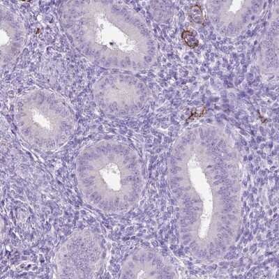 Immunohistochemistry-Paraffin: SIRP delta Antibody [NBP2-31924] - Staining of human endometrium shows low expression as expected.