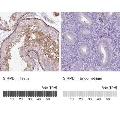 <b>Orthogonal Strategies Validation. </b>Immunohistochemistry-Paraffin: SIRP delta Antibody [NBP2-31924] - Staining in human testis and endometrium tissues using anti-SIRPD antibody. Corresponding SIRPD RNA-seq data are presented for the same tissues.