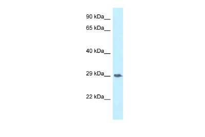 Western Blot: SIRP gamma/CD172g Antibody [NBP2-82342] - WB Suggested Anti-SIRPG Antibody. Titration: 1.0 ug/ml. Positive Control: 293T Whole Cell