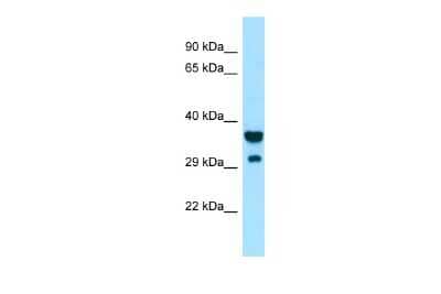 Western Blot: SIRP gamma/CD172g Antibody [NBP2-82343] - Host: Rabbit. Target Name: SIRPG. Sample Type: ACHN Whole Cell lysates. Antibody Dilution: 1.0ug/ml