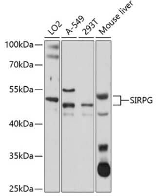 Western Blot: SIRP gamma/CD172g Antibody [NBP2-93281] - Analysis of extracts of various cell lines, using SIRP gamma/CD172g at 1:1000 dilution. Secondary antibody: HRP Goat Anti-Rabbit IgG (H+L) at 1:10000 dilution. Lysates/proteins: 25ug per lane. Blocking buffer: 3% nonfat dry milk in TBST. Detection: ECL Basic Kit . Exposure time: 30s.