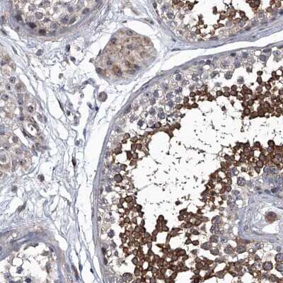 Immunohistochemistry-Paraffin: SIRT4 Antibody [NBP1-80746] - Staining of human testis shows high expression.