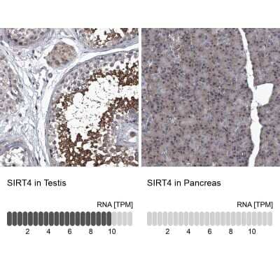 <b>Orthogonal Strategies Validation. </b>Immunohistochemistry-Paraffin: SIRT4 Antibody [NBP1-80746] - Staining in human testis and pancreas tissues using anti-SIRT4 antibody. Corresponding SIRT4 RNA-seq data are presented for the same tissues.