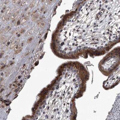 Immunohistochemistry-Paraffin: SIRT4 Antibody [NBP1-80747] - Staining of human placenta shows strong cytoplasmic positivity in trophoblastic cells.