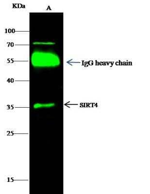 Immunoprecipitation: SIRT4 Antibody [NBP2-98856] - Lane A:0.5 mg Jurkat Whole Cell Lysate0.5 uL anti-SIRT4 rabbit polyclonal antibody and 60 ug of Immunomagnetic beads Protein G.Primary antibody:Anti-SIRT4 rabbit polyclonal antibody,at 1:500 dilution Secondary antibody:Dylight 800-labeled antibody to rabbit IgG (H+L), at 1:5000 dilution Developed using the odssey technique.Performed under reducing conditions.Predicted band size: 35 kDaObserved band size: 35 kDa