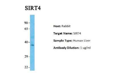 Western Blot: SIRT4 Antibody [NBP1-80002] - Sample Tissue: Human Fetal Liver Antibody Dilution: 1.0 ug/ml