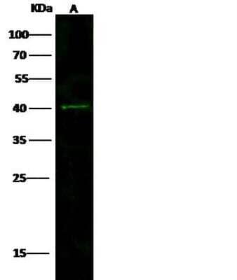 Western Blot: SIRT4 Antibody [NBP2-98856] - Lane A: MCF7 Whole Cell LysateLysates/proteins at 30 ug per lane.SecondaryGoat Anti-Rabbit IgG H&L (Dylight800) at 1/10000 dilution.Developed using the Odyssey technique. Performed under reducing conditions.Predicted band size:35 kDaObserved band size:40 kDa