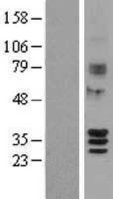 Western Blot SIRT4 Overexpression Lysate