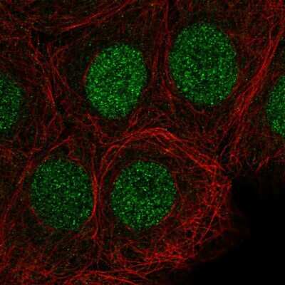 Immunocytochemistry/Immunofluorescence: SIRT6 Antibody [NBP2-56220] - Staining of human cell line MCF7 shows localization to nucleoplasm.