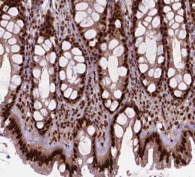 Immunohistochemistry-Paraffin: SIRT6 Antibody [NBP2-49668] - Staining of human colon shows strong nuclear positivity in glandular cells.