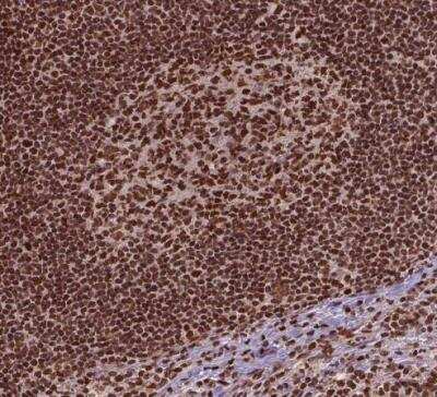 Immunohistochemistry-Paraffin: SIRT6 Antibody [NBP2-49668] - Staining of human lymph node shows strong nuclear positivity in germinal center cells and non-germinal center cells.