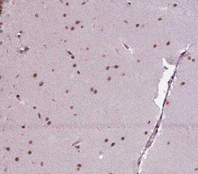 Immunohistochemistry-Paraffin: SIRT6 Antibody [NBP2-49668] - Staining of human cerebellum shows strong nuclear postivity in cells in molecular layer.