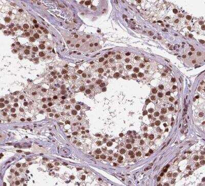 Immunohistochemistry-Paraffin: SIRT6 Antibody [NBP2-49668] - Staining of human testis shows strong nuclear postivity in cells in seminiferous ducts and Leydig cells.