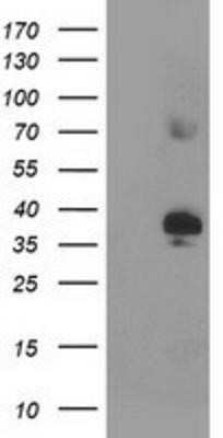 Western Blot: SIRT6 Antibody (OTI1G3) - Azide and BSA Free [NBP2-74198] - HEK293T cells were transfected with the pCMV6-ENTRY control (Left lane) or pCMV6-ENTRY SIRT6 (Right lane) cDNA for 48 hrs and lysed. Equivalent amounts of cell lysates (5 ug per lane) were separated by SDS-PAGE and immunoblotted with anti-SIRT6.