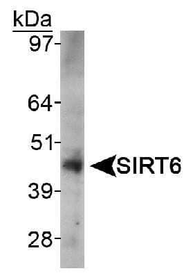 Western Blot: SIRT6 Antibody [NB100-2523] - Detection of SIRT6 in HeLa whole cell lysate.