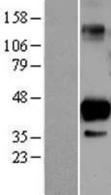 Western Blot: SIRT6 Overexpression Lysate (Adult Normal) [NBL1-15979] Left-Empty vector transfected control cell lysate (HEK293 cell lysate); Right -Over-expression Lysate for SIRT6.