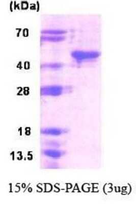 SDS-Page: SIRT6 Protein [NBC1-18433] - SIRT6, 41 kDa (375 aa), confirmed by MALDI-TOF with a purity of 95% by SDS - PAGE