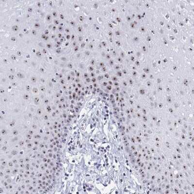Immunohistochemistry-Paraffin: SIRT7 Antibody [NBP2-47276] - Staining of human esophagus shows nucleolar positivity in squamous epithelial cells.