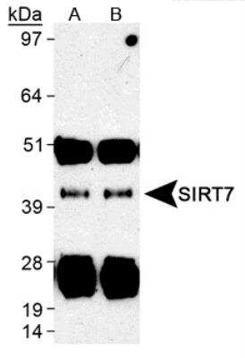 Western Blot: SIRT7 Antibody [NB110-81746] - SIRT7 Immunoprecipitated from human liver lysates with NB110-81762. A). NB110-81746 B). NB110-81744