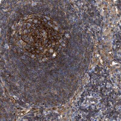 Immunohistochemistry-Paraffin: SIT1 Antibody [NBP2-13311] - Staining of human lymph node shows high expression.