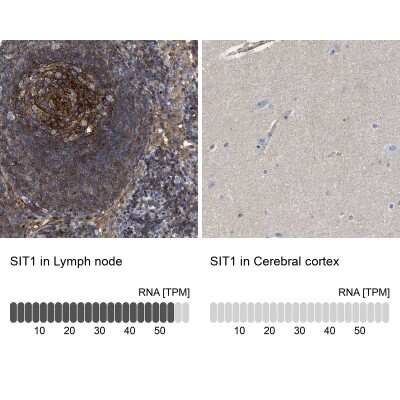 Immunohistochemistry-Paraffin: SIT1 Antibody [NBP2-13311] - Staining in human lymph node and cerebral cortex tissues using anti-SIT1 antibody. Corresponding SIT1 RNA-seq data are presented for the same tissues.