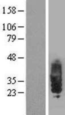 Western Blot: SIT1 Overexpression Lysate (Adult Normal) [NBP2-07336] Left-Empty vector transfected control cell lysate (HEK293 cell lysate); Right -Over-expression Lysate for SIT1.