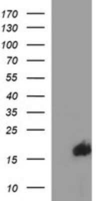 Western Blot: SIVA Antibody (OTI2F8) - Azide and BSA Free [NBP2-74208] - Analysis of HEK293T cells were transfected with the pCMV6-ENTRY control (Left lane) or pCMV6-ENTRY SIVA.
