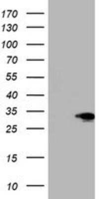 Western Blot: SIX1 Antibody (OTI1H4) - Azide and BSA Free [NBP2-74209] - HEK293T cells were transfected with the pCMV6-ENTRY control (Left lane) or pCMV6-ENTRY SIX1 (Right lane) cDNA for 48 hrs and lysed. Equivalent amounts of cell lysates (5 ug per lane) were separated by SDS-PAGE and immunoblotted with anti-SIX1.