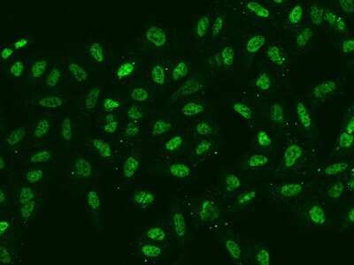 Immunocytochemistry/Immunofluorescence: SIX4 Antibody [NBP2-98472] - Immunofluorescence staining of SIX4 in U2OS cells. Cells were fixed with 4% PFA, permeabilzed with 0.1% Triton X-100 in PBS, blocked with 10% serum, and incubated with rabbit anti-Human SIX4 polyclonal antibody (dilution ratio 1:200) at 4C overnight. Then cells were stained with the Alexa Fluor(R)488-conjugated Goat Anti-rabbit IgG secondary antibody (green). Positive staining was localized to Nucleus.