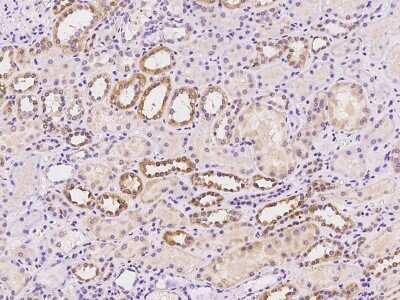 Immunohistochemistry-Paraffin: SIX4 Antibody [NBP2-98472] - Immunochemical staining of human SIX4 in human kidney with rabbit polyclonal antibody at 1:100 dilution, formalin-fixed paraffin embedded sections.