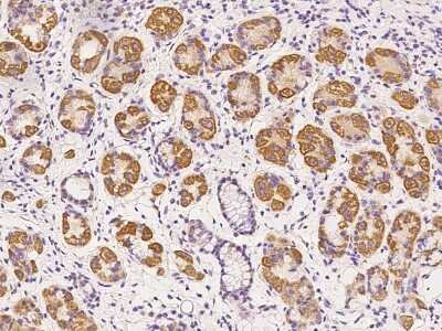 Immunohistochemistry-Paraffin: SIX4 Antibody [NBP2-98472] - Immunochemical staining of human SIX4 in human stomach with rabbit polyclonal antibody at 1:100 dilution, formalin-fixed paraffin embedded sections.