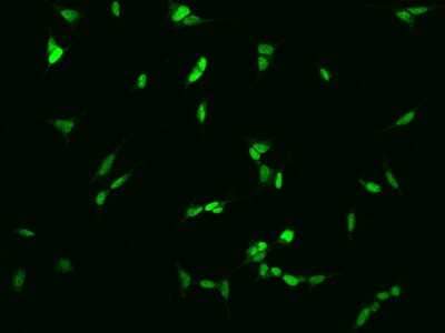 Immunocytochemistry/Immunofluorescence: SIX6 Antibody [NBP2-98116] - Immunofluorescence staining of SIX6 in SHSY5Y cells. Cells were fixed with 4% PFA, permeabilzed with 0.1% Triton X-100 in PBS, blocked with 10% serum, and incubated with rabbit anti-Human SIX6 polyclonal antibody (dilution ratio 1:200) at 4C overnight. Then cells were stained with the Alexa Fluor(R)488-conjugated Goat Anti-rabbit IgG secondary antibody (green). Positive staining was localized to Nucleus.