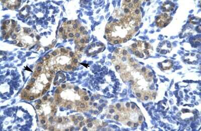 Immunohistochemistry: SIX6 Antibody [NBP2-83529] - Human kidney