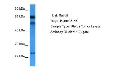 Western Blot: SIX6 Antibody [NBP2-83525] - Host: Rabbit. Target Name: SIX6. Sample Tissue: Uterus Tumor lysates. Antibody Dilution: 1ug/ml